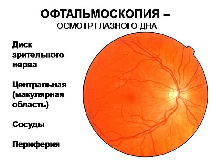 Офтальмоскопия 