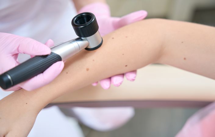 Исследование кожи при помощи дерматоскопа